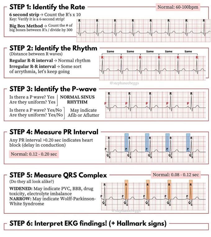 ECG Review I