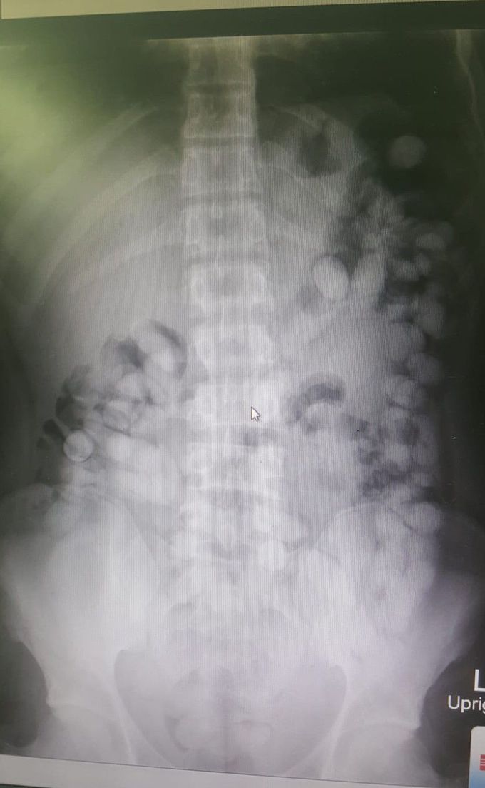 Diagnosis?