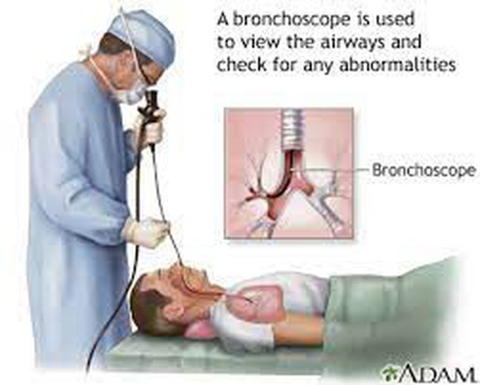 Risks of bronchoscopy