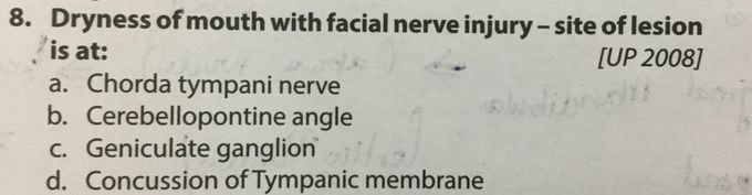 Facial nerve injury