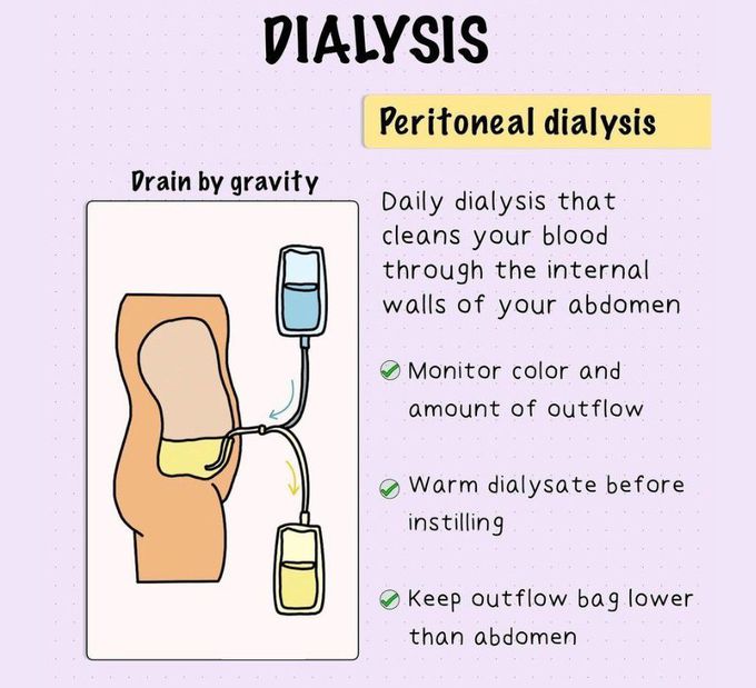 Dialysis II