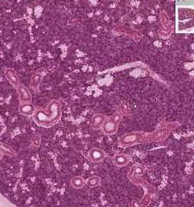 Accessory Glands of GIT- Submandibular Glands