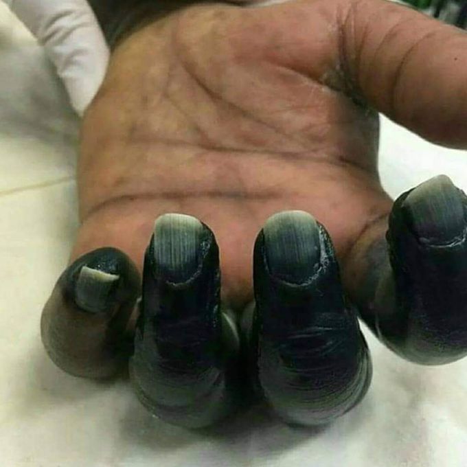 Whats your dx and treatment plan? 