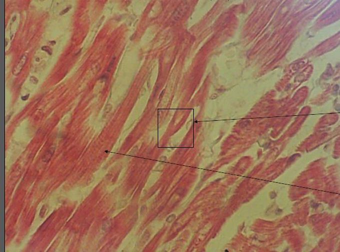 Cardiac muscle
