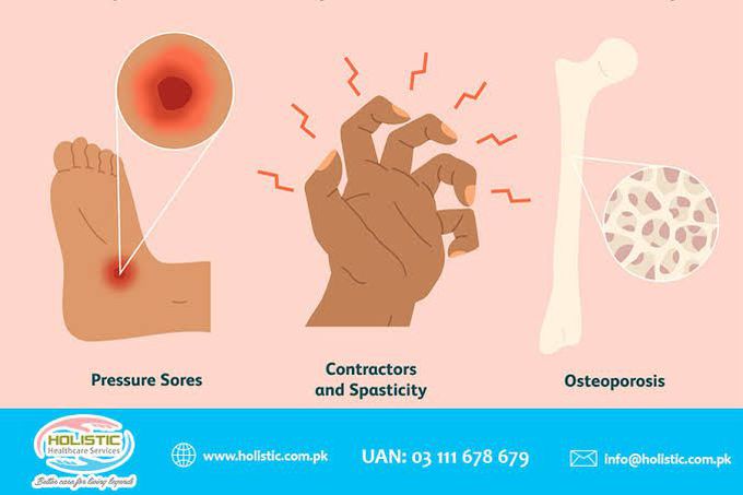 Cause of multiple sclerosis