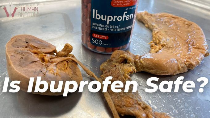 What Ibuprofen Does to the Body?
