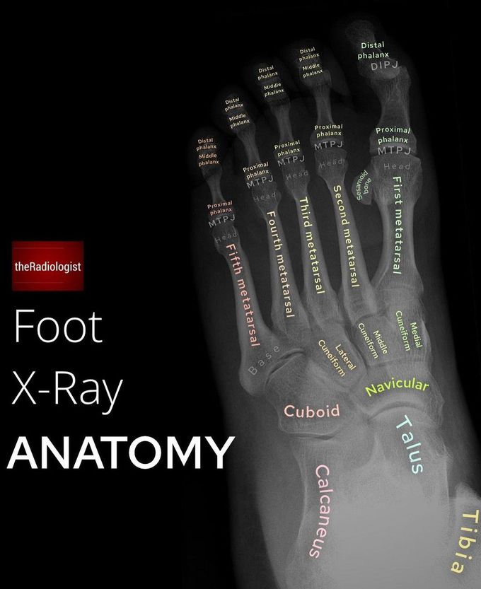 Foot X-ray Anatomy