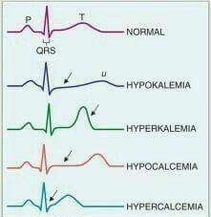 Ecg learning