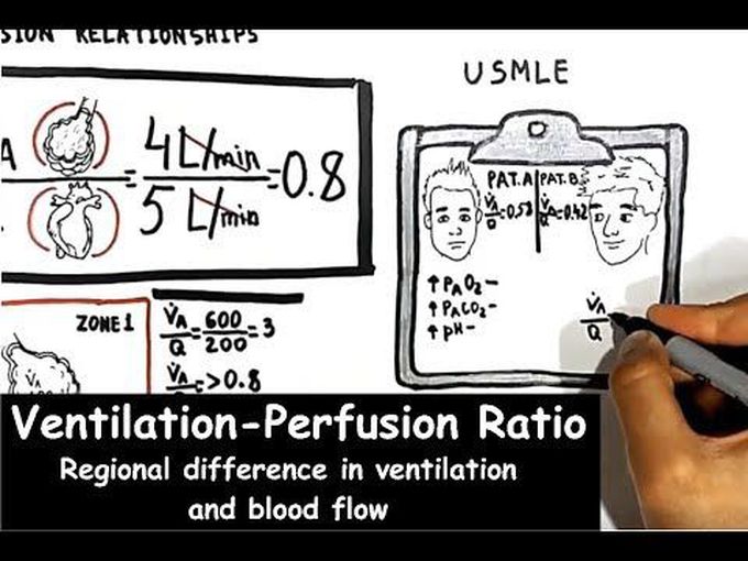 Ventilation and Perfusion -
Regional Difference