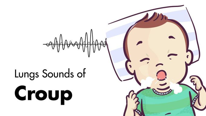 Croup - Sounds and Disease Overview