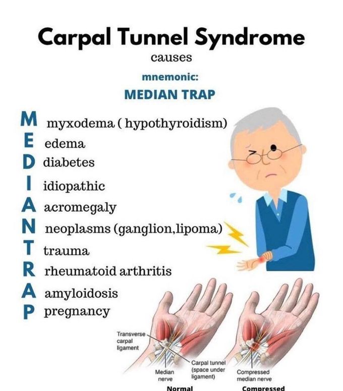 Carpal Tunnel Syndrome