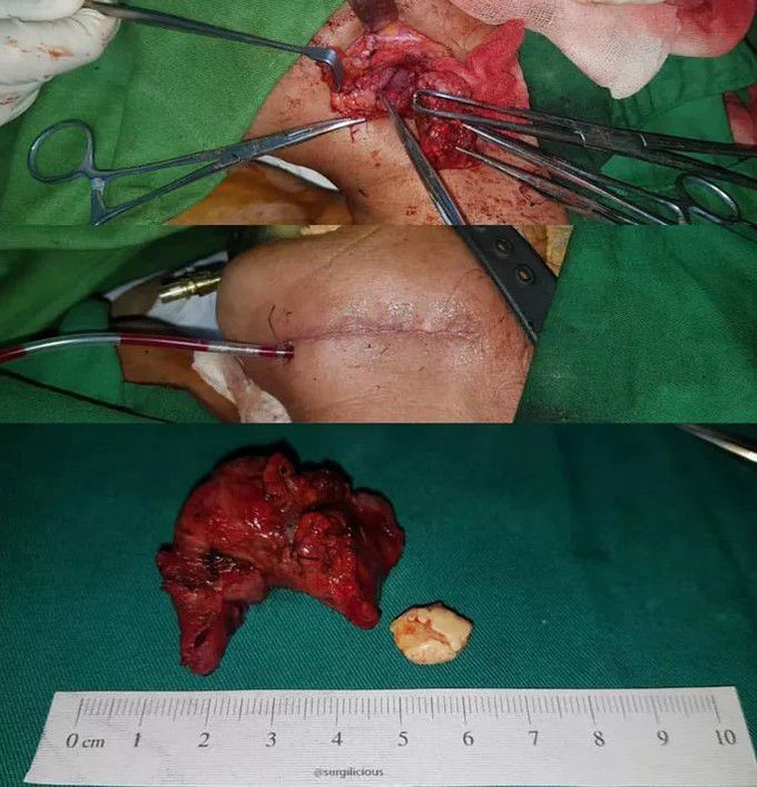 general surgery