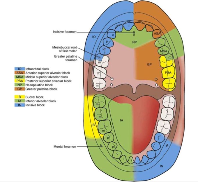 Dental Anesthesia MEDizzy