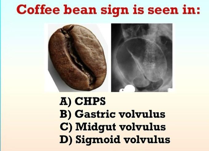 Coffee Bean Sign