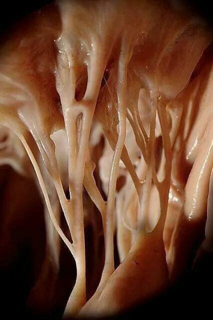 Chorda tendineae of heart