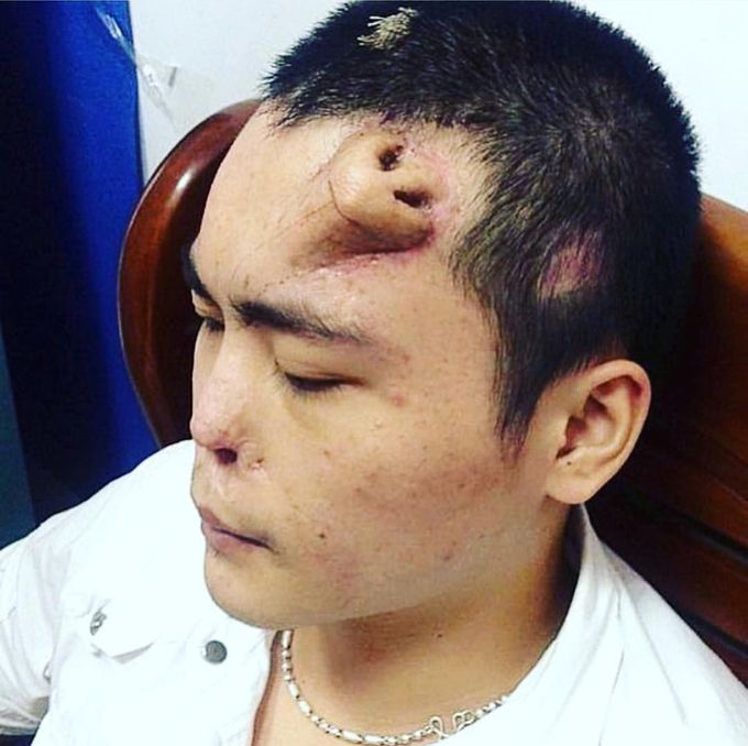 Amazing medical case