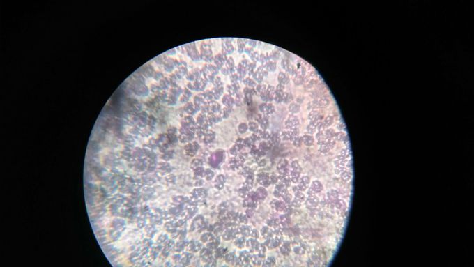 Wbc and rbc with giemsa