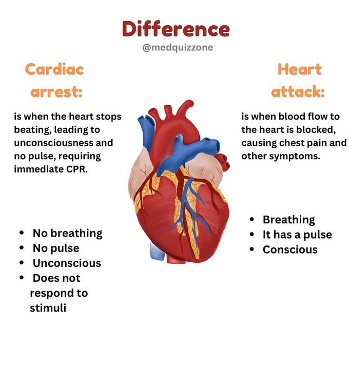 Cardiac Arrest Vs Heart Attack