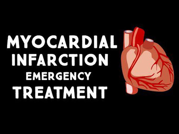 Myocardial Infarction-Treatment