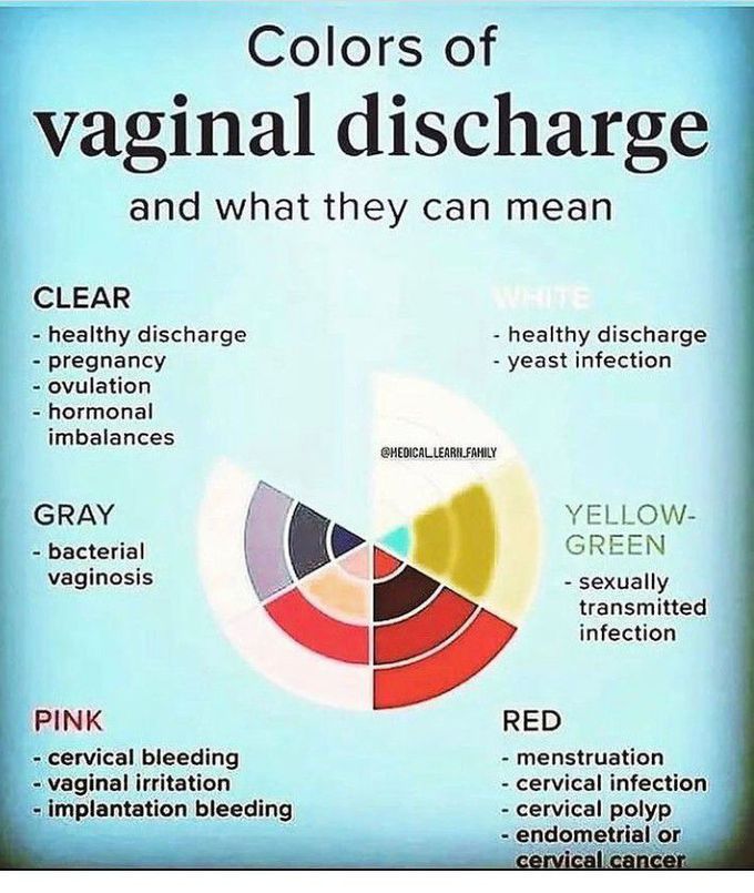 Colors Of Vaginal Discharge Medizzy 