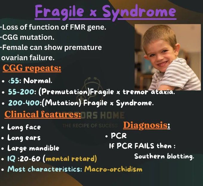 Fragile X Syndrome