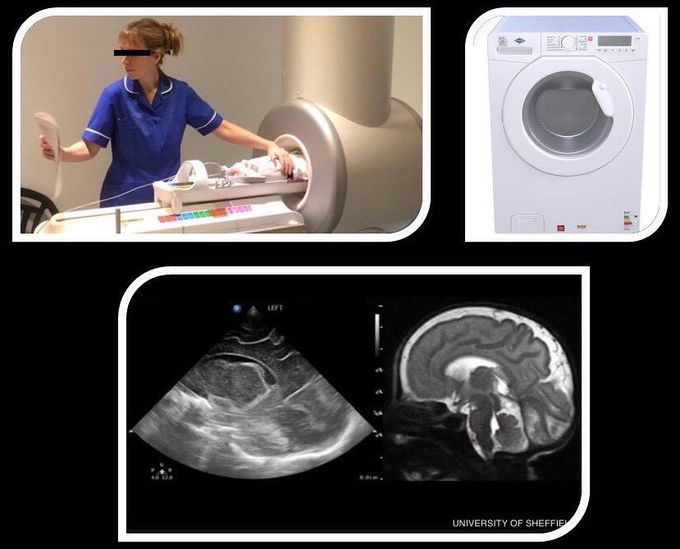 MRI scanner for imaging the brains of premature babies