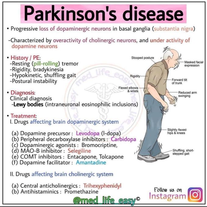 Parkinson Disappointed