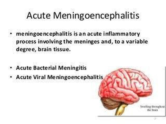 Meningoencephalitis