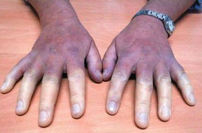 What's your dx