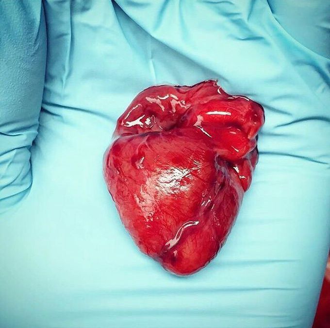 A tiny piece of heart