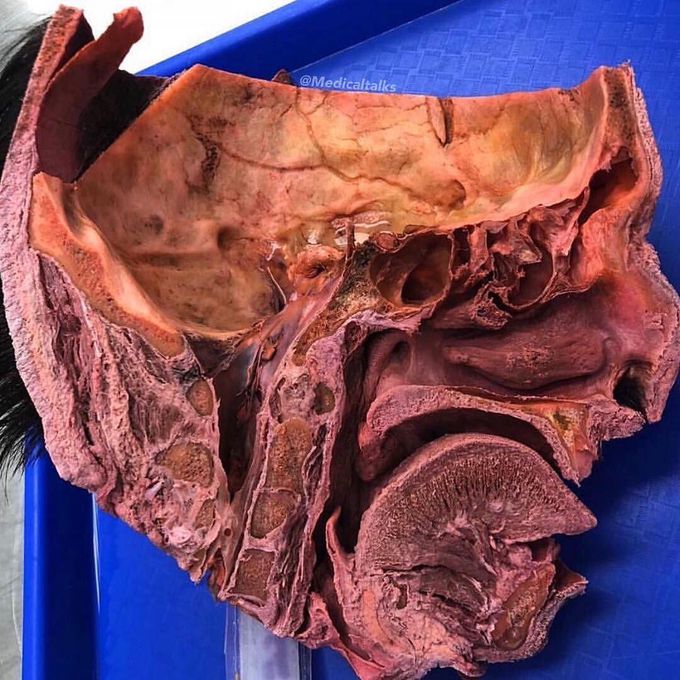 Mid-sagittal plane cross section of the human head!! 