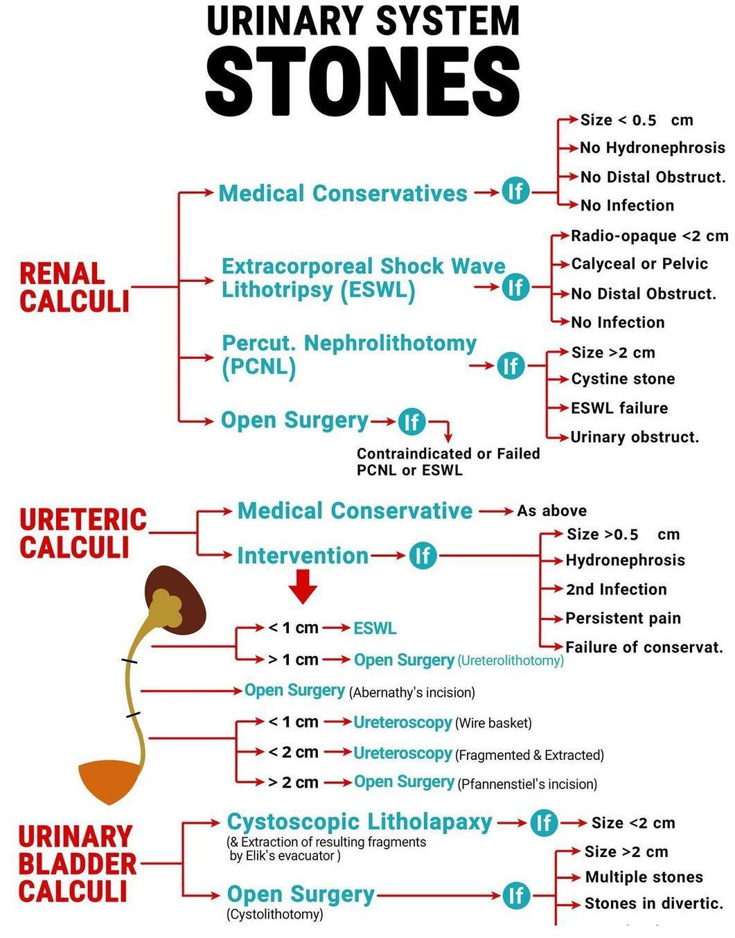 Urinary Stones - MEDizzy