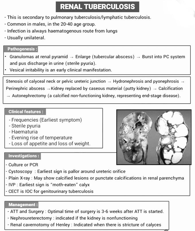 Renal Tuberculosis