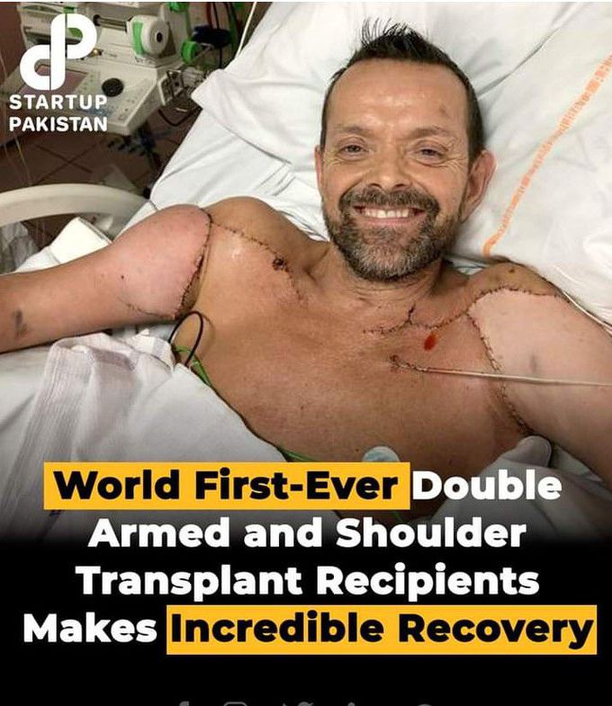 World's First Double Arm and Shoulder Transplant