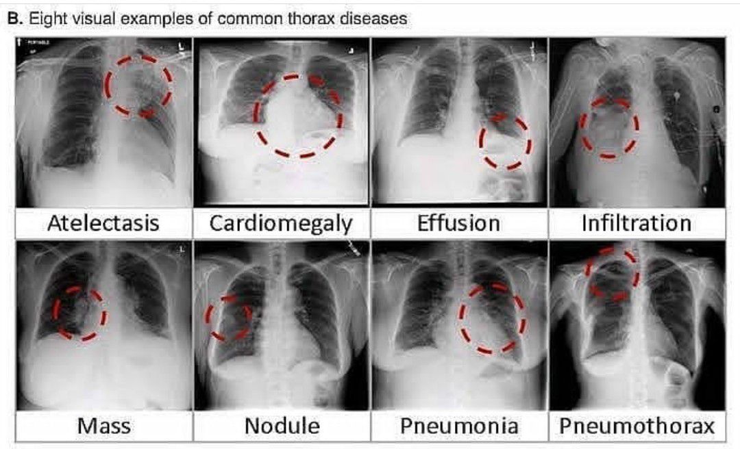 Thorax x ray - MEDizzy