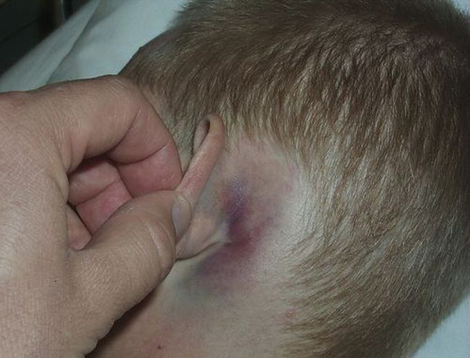 Diagnosis?