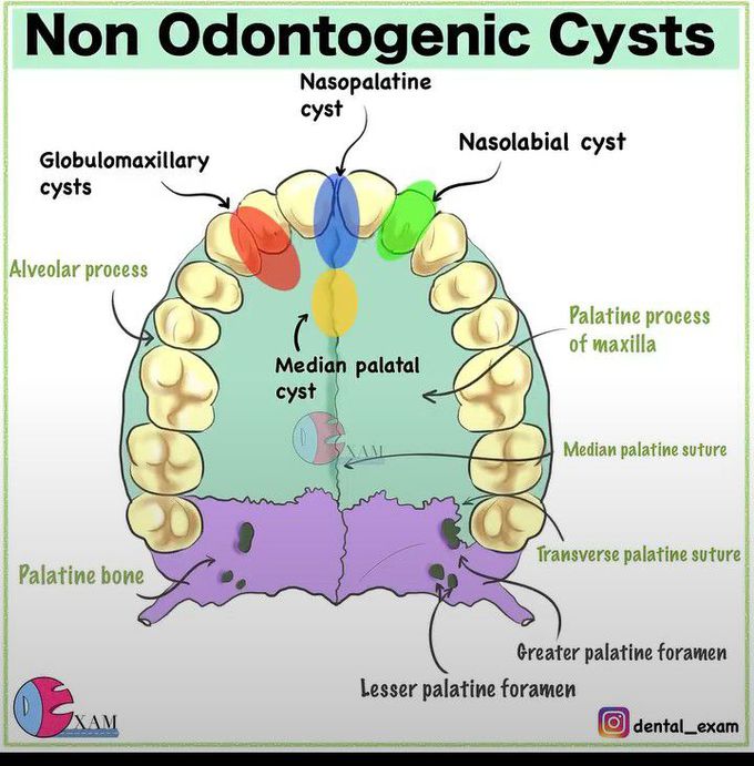 Non-odontogenic Cysts