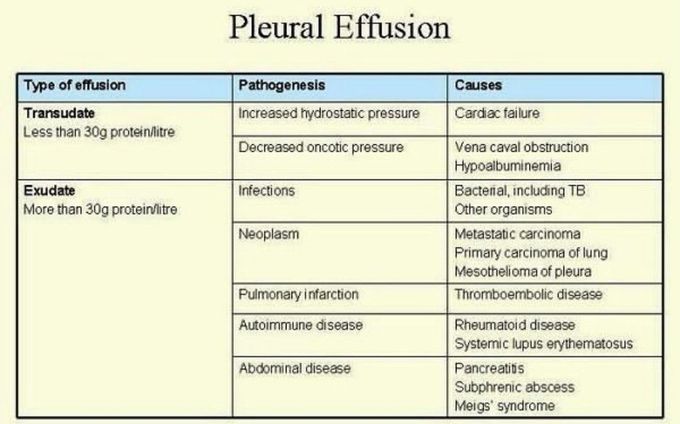 Pleural Effusion