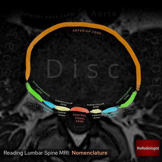 READING LUMBAR SPINE MRI⁣