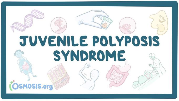 Juvenile polyposis syndrome