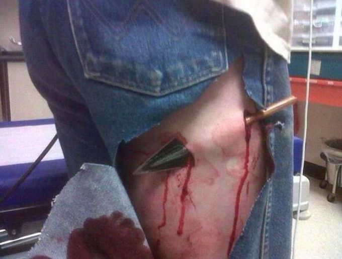 Arrow accident