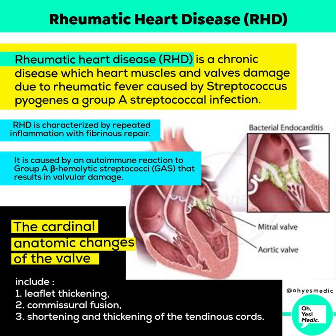 Rheumatic heart disease (RHD)