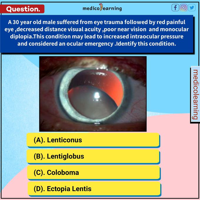 What will your Diagnosis?