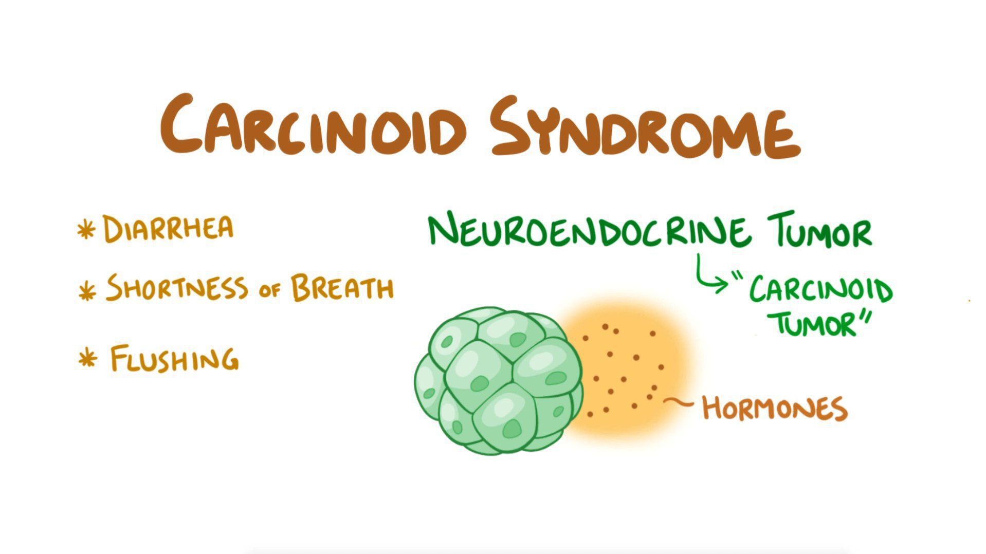 Carcinoid syndrome and carcinoid tumours - MEDizzy