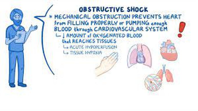 Obstructive shock