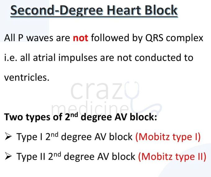 Heart Block IV