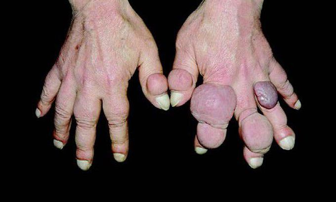 What is the diagnosis?
