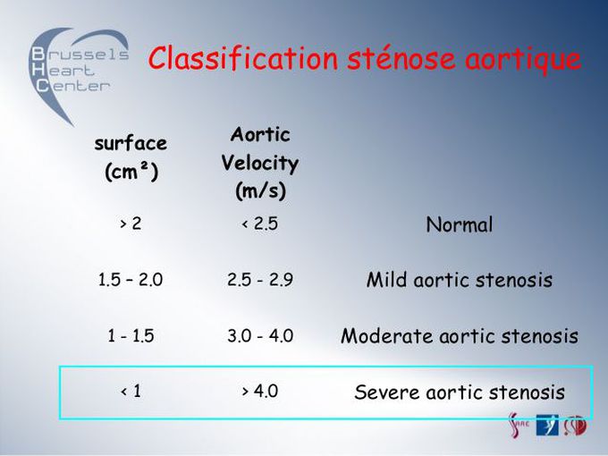 Aortic Stenosis grading on echo valve assessment