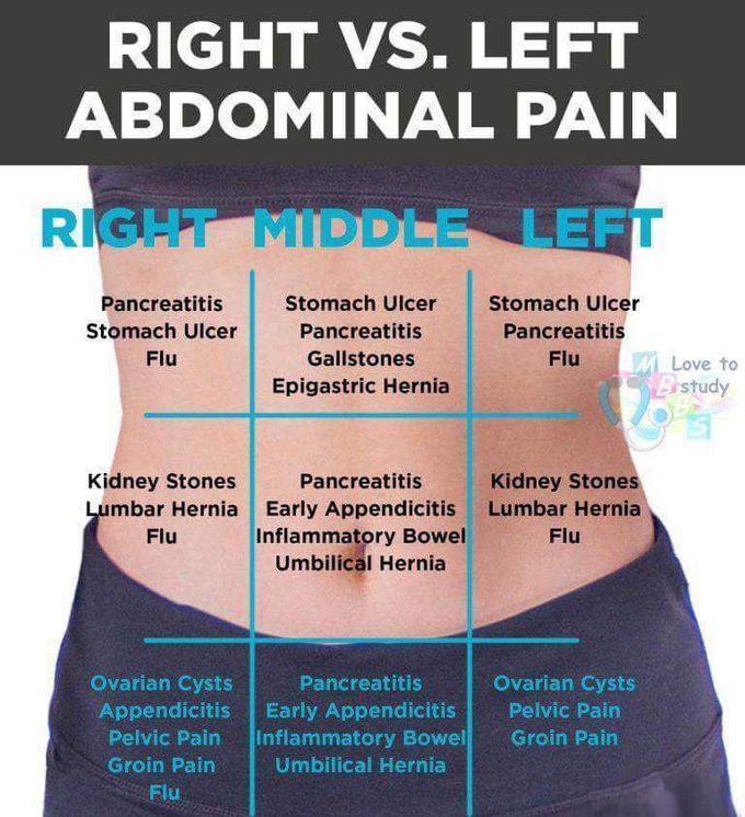 Pain in abdomen. - MEDizzy