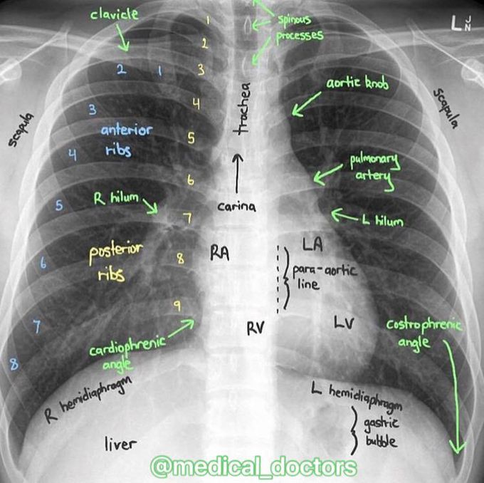 Reading a x ray